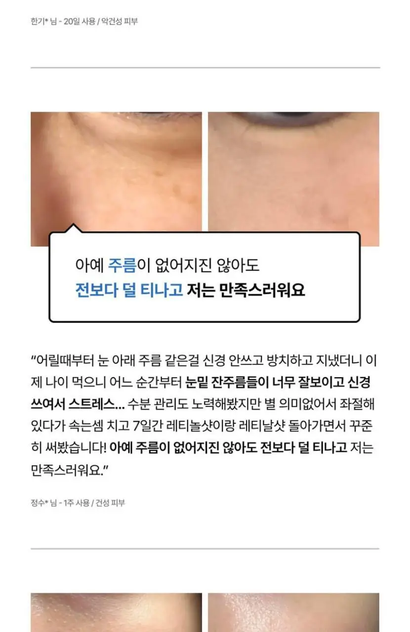 [모공탄력] 셀리맥스 더 비타 A 레티날 샷 타이트닝 부스터 15ml 상세페이지 3